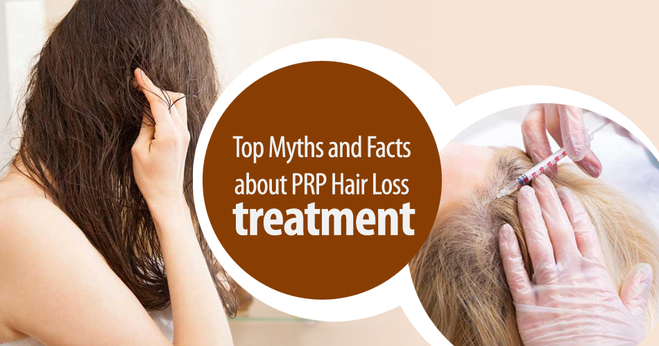 FACTS ABOUT PRP FOR HAIR LOSS TREATMENT