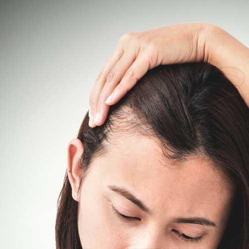 Female Hair Loss Treatment In Kurnool