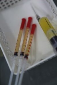 PLATELET RICH PLASMA (PRP)